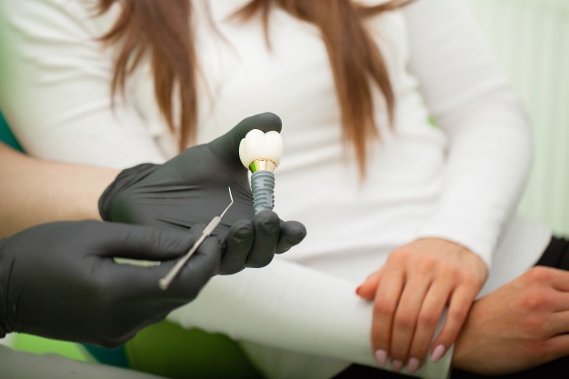 哪些因素會影響到種植牙的壽命 術後如何護理