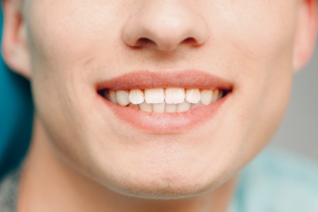 半口種植牙能用多少年？