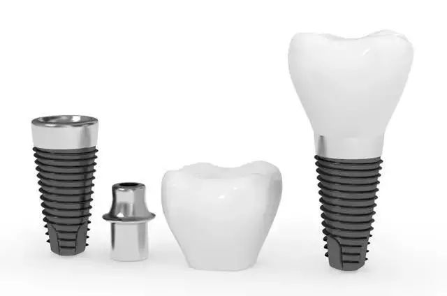 種植牙修複多數牙缺失的優點