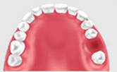 種植牙術後注意調理3種關系