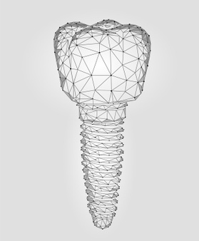 3D種植牙技術