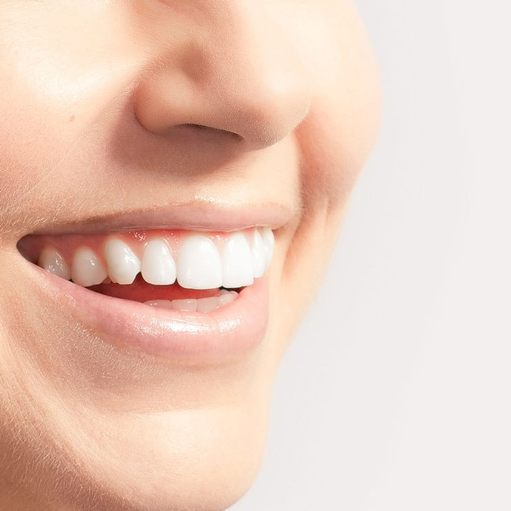 牙齒缺失選擇種植牙還是傳統假牙-