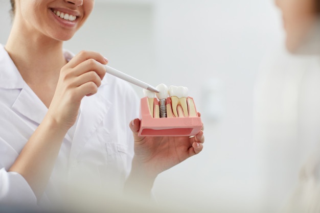 種植牙術後怎樣護理？