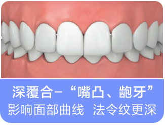成年以後，我們還需要箍牙嗎？對於箍牙這件事，你怎麼看待