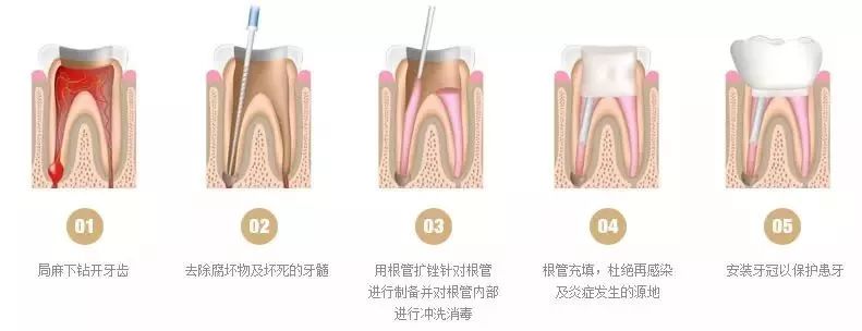 讓你秒懂牙科，分分鐘解鎖牙齒新姿勢